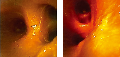 USHIO Theia-40 系列內(nèi)窺鏡實(shí)際效果